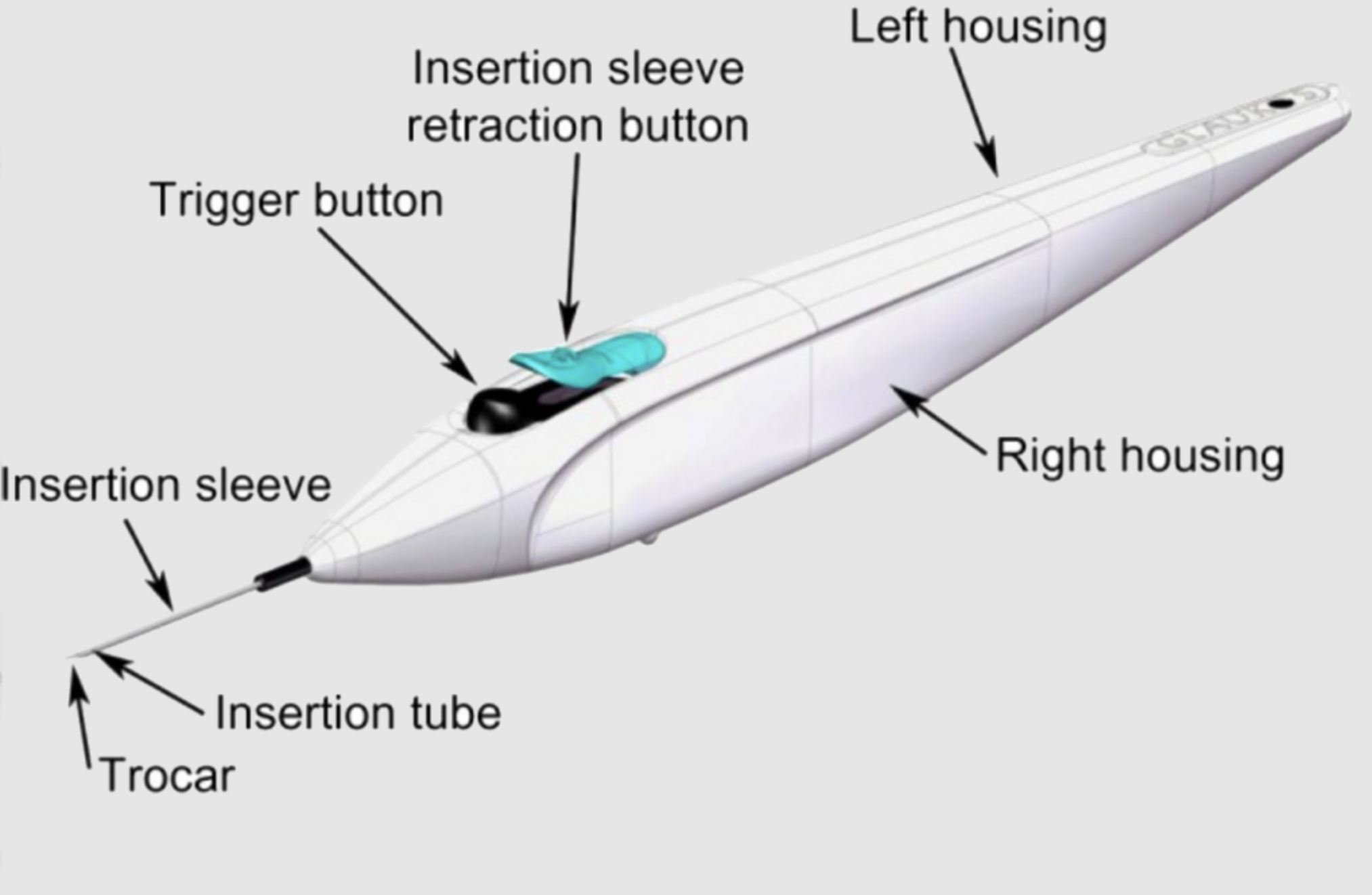 Diagram of the iStent® trabecular micro-bypass device used to treat mild to moderate open-angle glaucoma