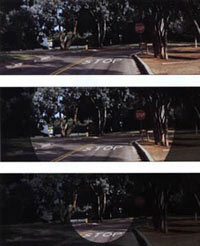 Glaucoma Tunnel Vision