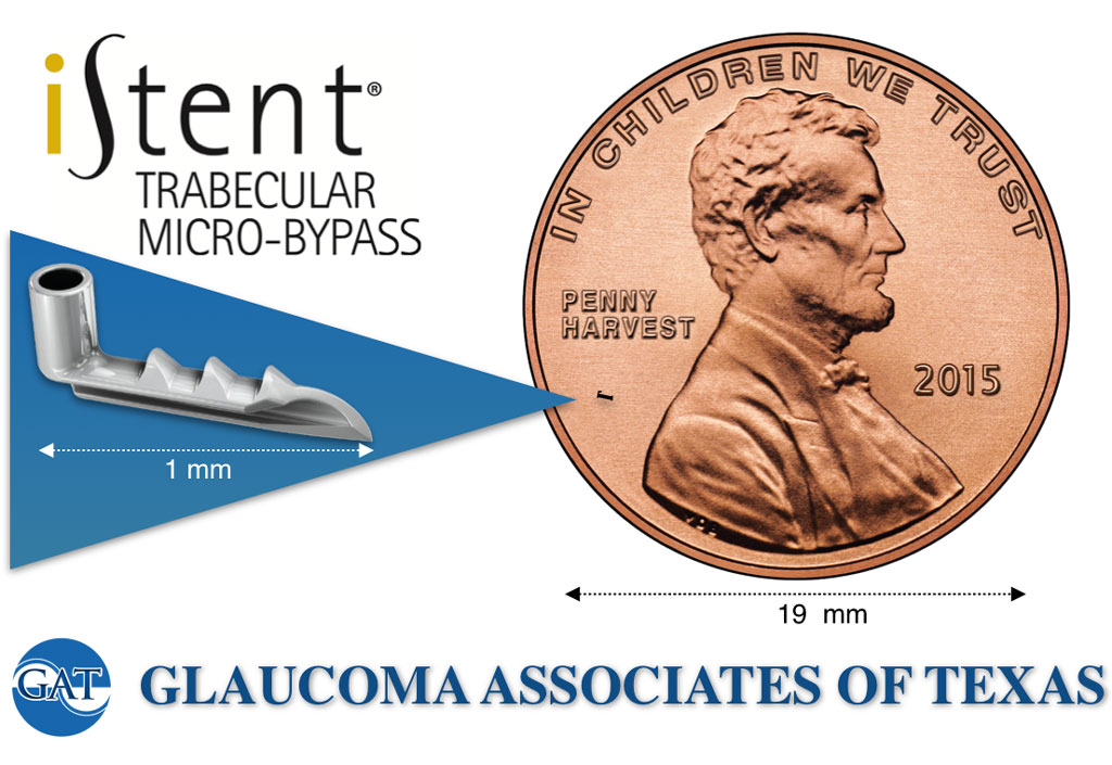iStent® Trabecular Micro-bypass